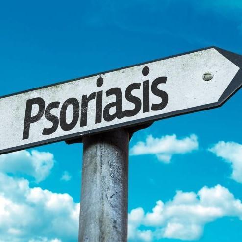 Ako sa zbaviť psoriázy